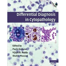 Differential Diagnosis In Cytopathology