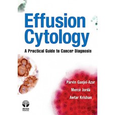 Effusion Cytology - A Practical Guide To Cancer Diagnosis