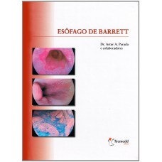 Esofago de Barrett